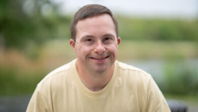 کودک مبتلا به سندرم داون در حال لبخند زدن