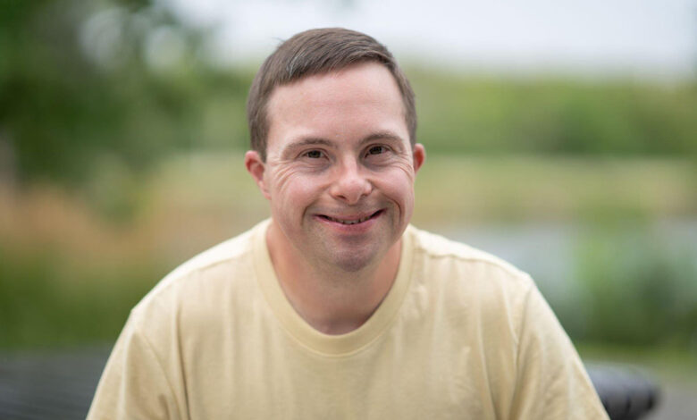 کودک مبتلا به سندرم داون در حال لبخند زدن